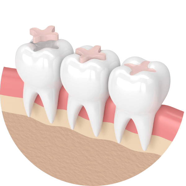 Restorative Dentistry